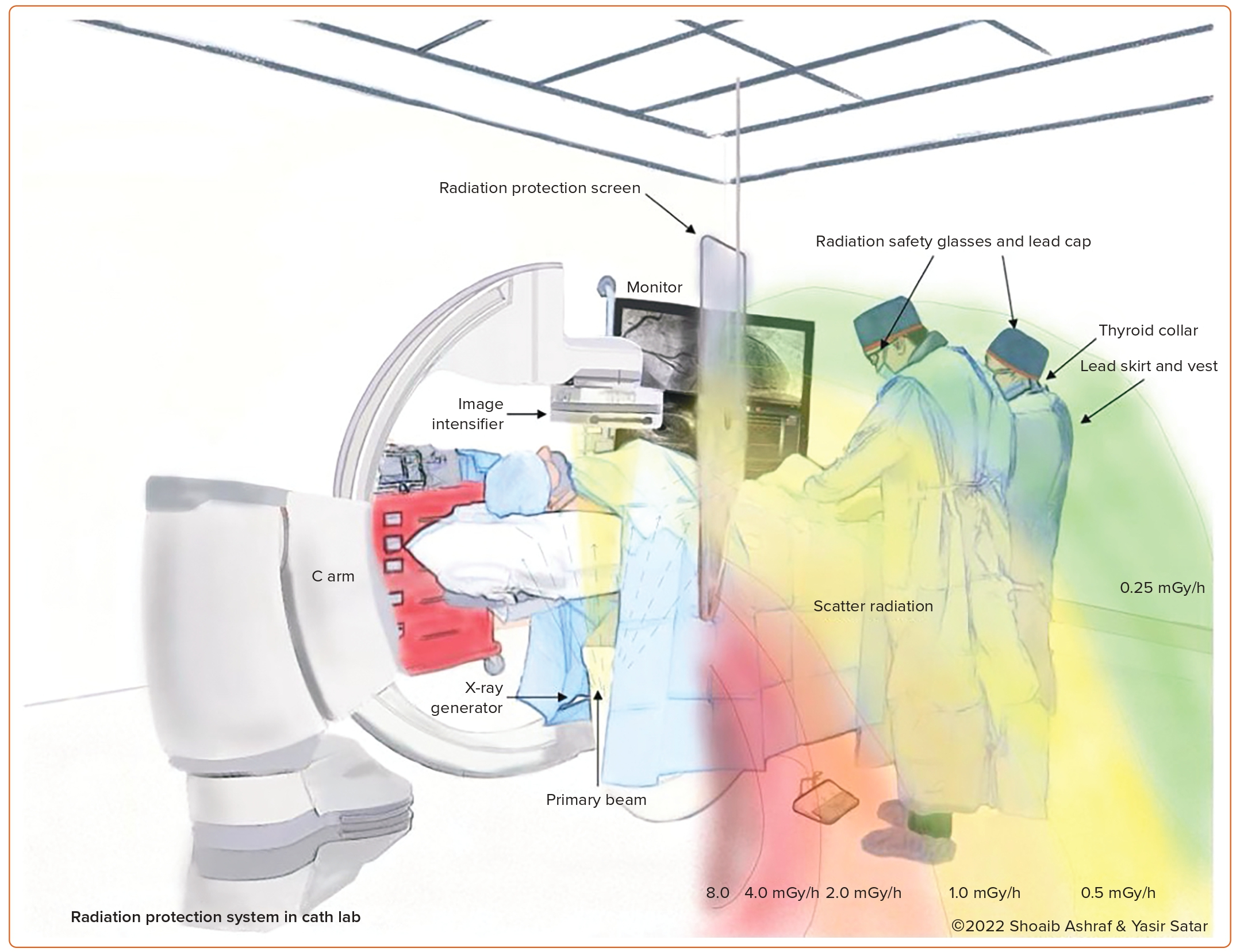 Figure 2 Radiation Protection System in the Cardiac Catheterisation